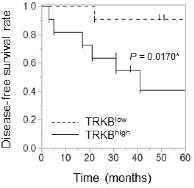 BDNF/TRKB轴通过与人腮腺癌中癌症相关成纤维细胞的串扰刺激EMT进展以诱导细胞侵袭性