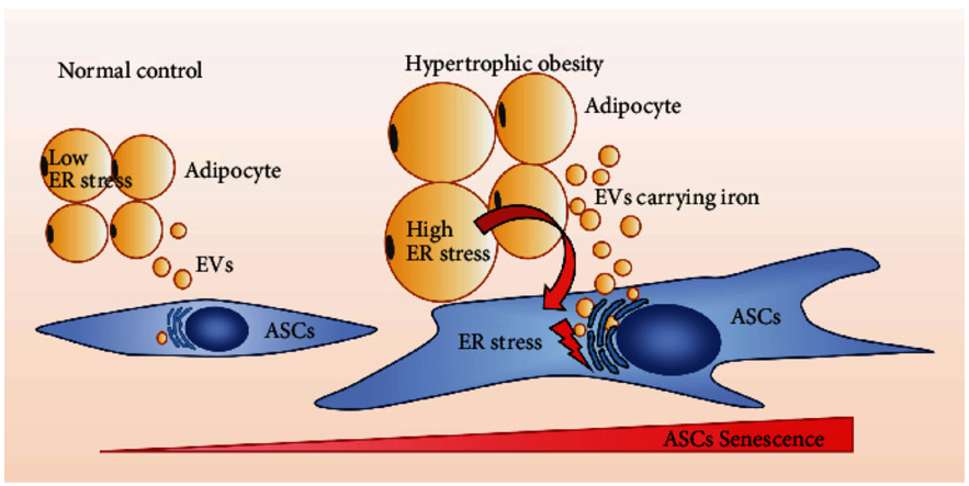 脂肪细胞胞外囊泡介导的可传递性内质网应激促进肥大性肥胖中脂肪来源的间充质干细胞衰老