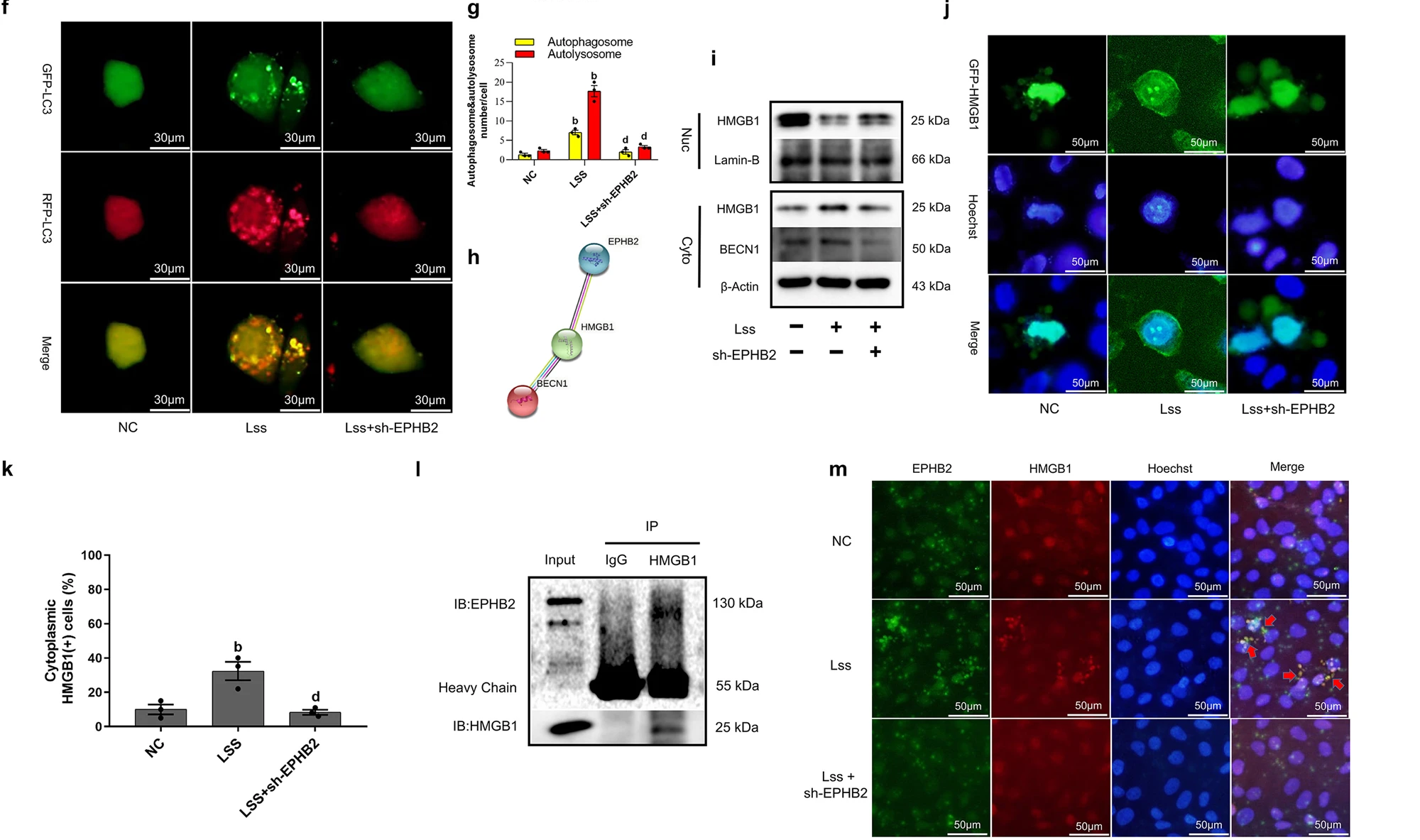 层流剪切应力通过 HMGB1 核转位激活人主动脉内皮细胞的自噬来抑制炎症