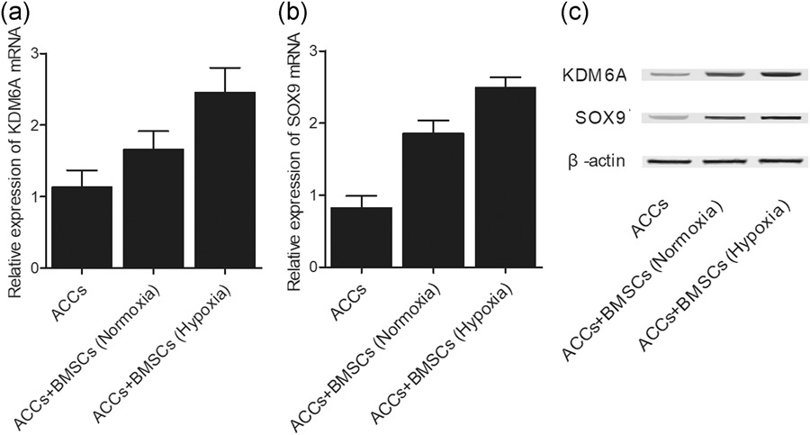 骨髓间充质干细胞对骨关节炎的治疗效果通过激活暴露于缺氧引起的 KDM6A / SOX9 信号通路而得到改善