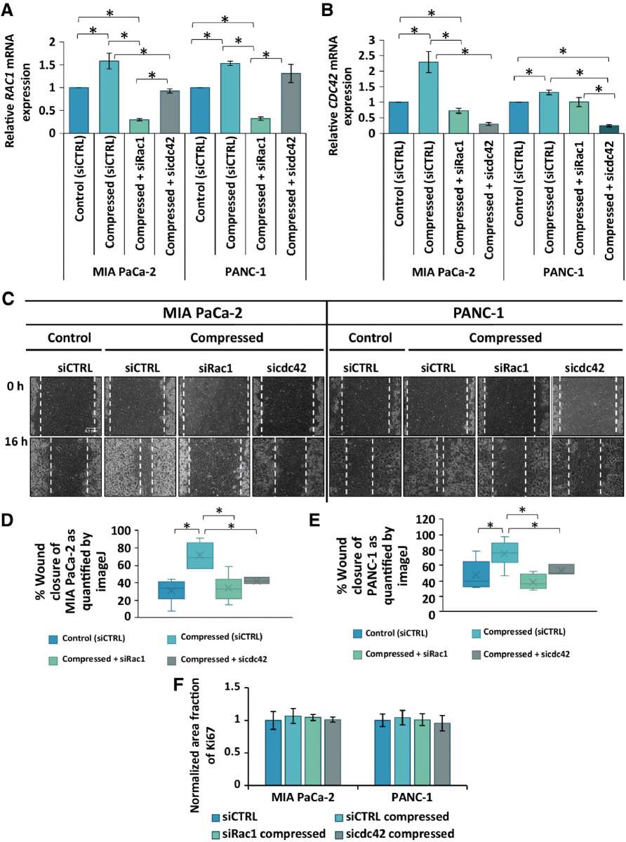 胰腺癌细胞中的机械应力信号触发p38 MAPK和JNK依赖性细胞骨架重塑，并通过Rac1 / cdc42 / 肌球蛋白II促进细胞迁移