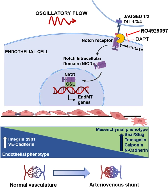 振荡剪切应力调节Notch介导的脑动静脉畸形内皮间充质可塑性