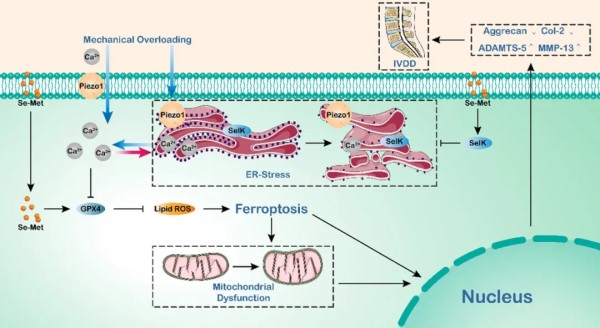 Selenium-SelK-GPX4 轴保护髓核细胞免受机械超负荷诱导的铁死亡并减缓椎间盘衰老