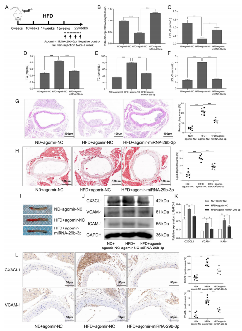 层流剪切应力通过调控 miR - 29b - 3p/CX3CL1 轴减轻单核细胞黏附及动脉粥样硬化发展