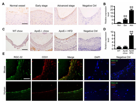 RGC-32 缺失可保护内皮细胞免受炎症损伤并减轻动脉粥样硬化